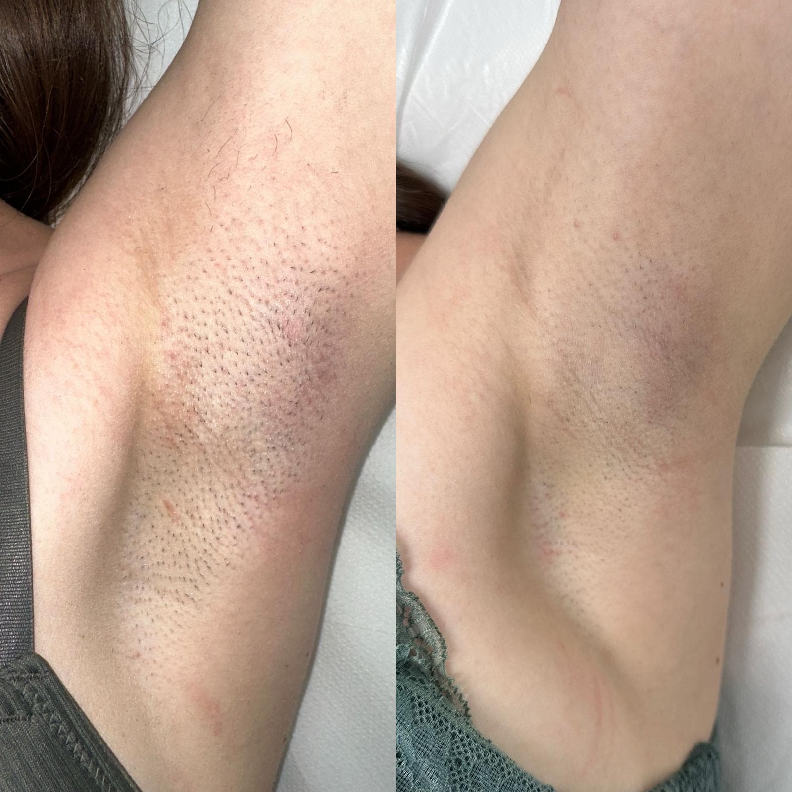 Axile - inainte si dupa