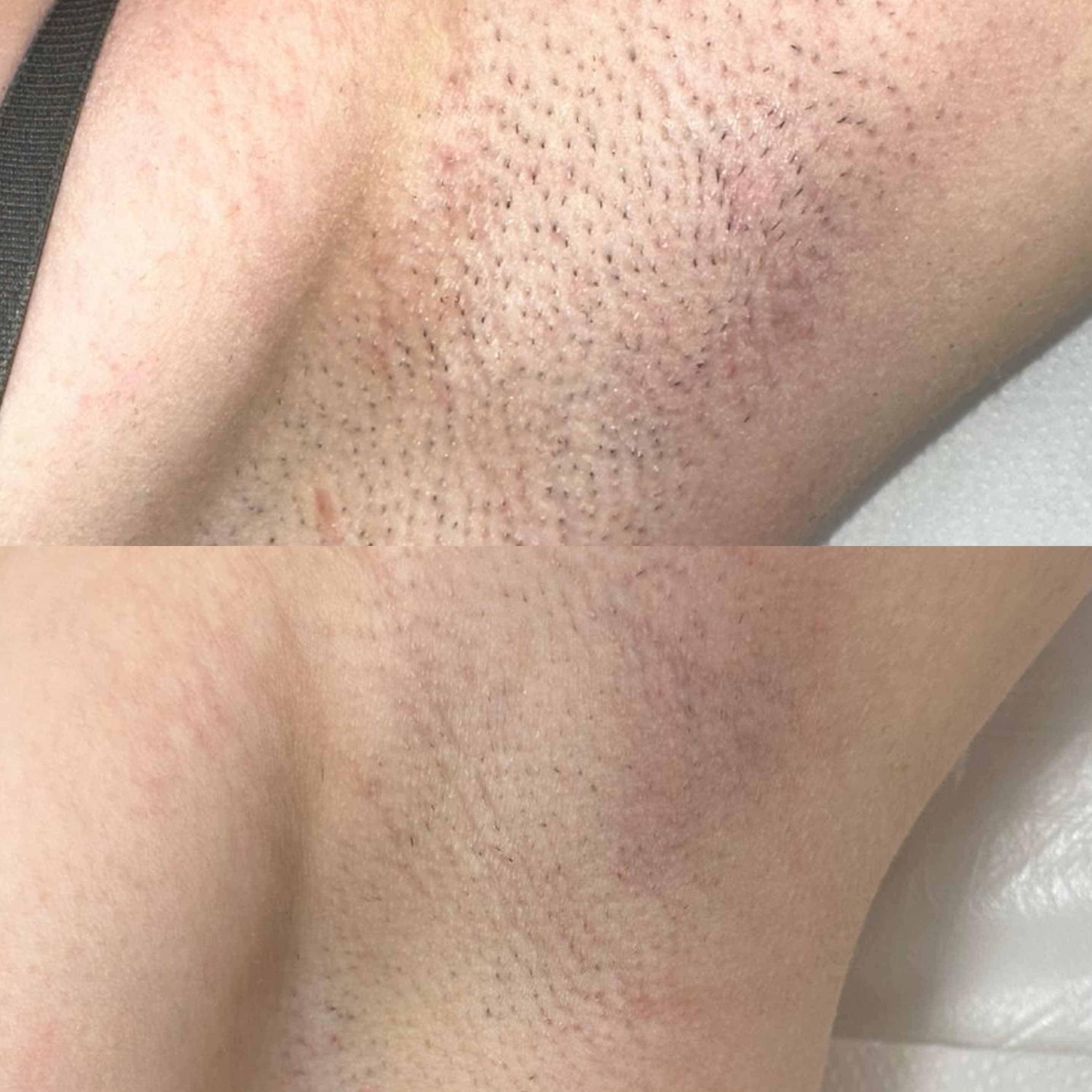 Axile - caz 3 - înainte și după