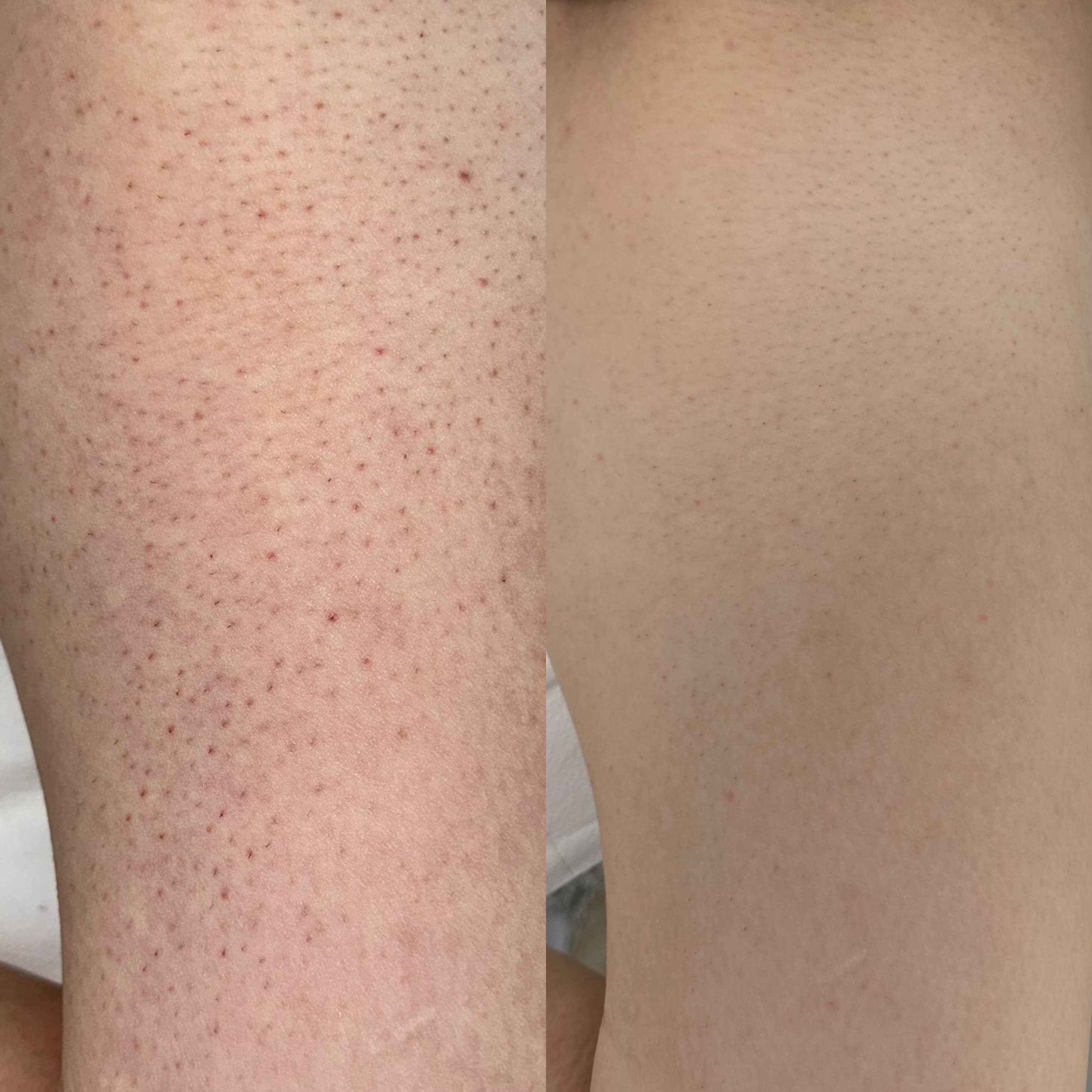 Picioare - inainte si dupa