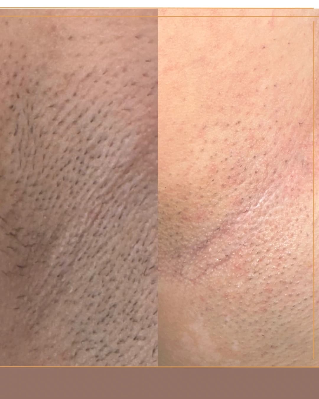 Axile - caz 2 - inainte si dupa