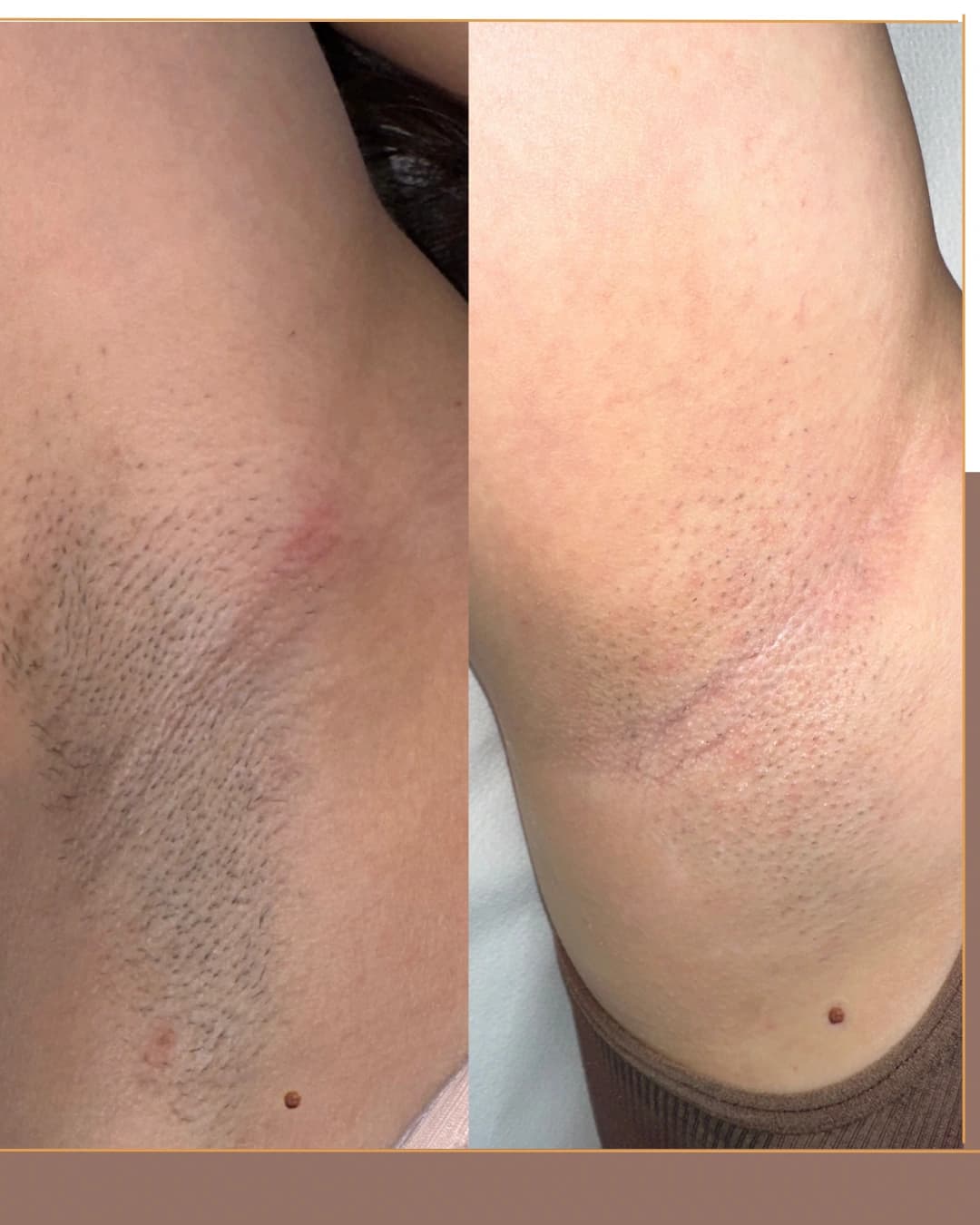 Axile - caz 3 - inainte si dupa